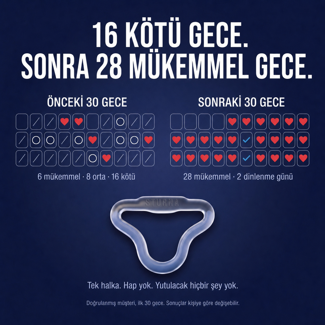 Sturna™ Performans Halkası — 3 Kademeli Kompresyon Sistemi